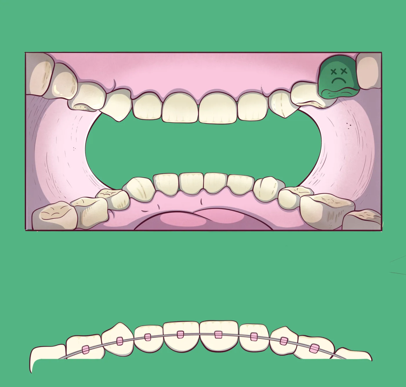 Final envelope artwork on green: an illustrated pink open mouth with cream teeth and one sad green molar on the inside panel, and braced teeth on the closing flap